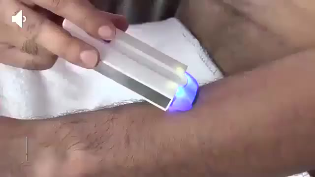 Depilador Recarregável Facial e Corporal para Ambos os Gêneros